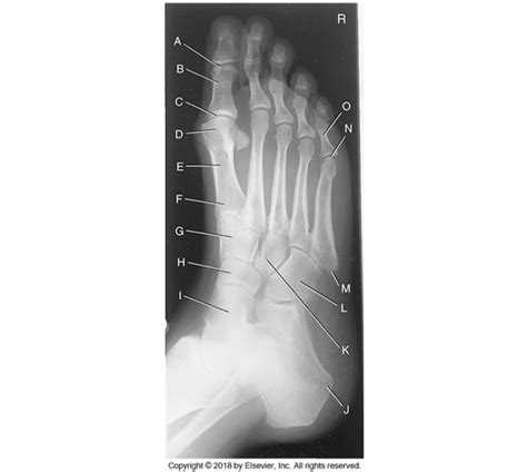 Ap Medial Oblique X Ray Foot Labeling Diagram Quizlet