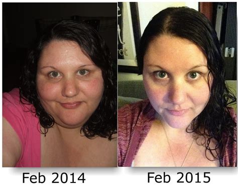 Post Your Face Pic Before And After Weight Loss Page 3 —