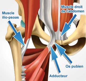 Pubalgie symptômes causes et traitement fonctionnel