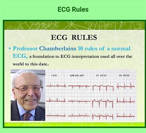 Thread By Fazalabul Chamberlains 10 Rules Of A Normal Ecg