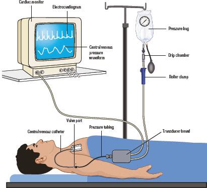 The cvp graph has two straight lines, sales and total costs. Art Line Transducer Level - Blog Art Zone