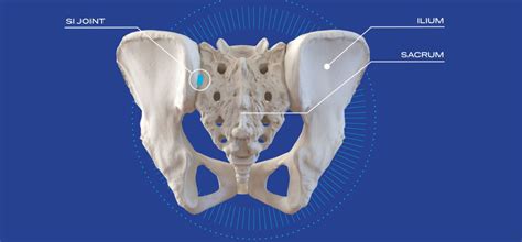 Minimally Invasive Sacroiliac SI Joint Fusion Advanced Pain Management And Wellness Center