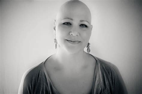 Shameless Mom Deeann Graham Head On Stories Of Alopecia