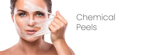 Best Chemical Peel Treatment In Lucknow The Skin Art Clinic