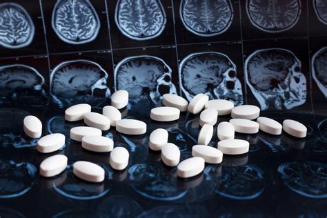 Alzheimers The United States Authorizes A Long Awaited New Drug Ace