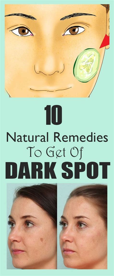 10 Diy Natural Remedies How To Get Rid Of Dark Spots On Face Health