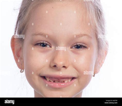 Girl Toothless Smile Hi Res Stock Photography And Images Alamy