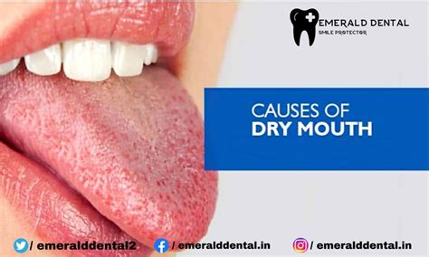 CAUSES OF DRY MOUTH - EMERALD DENTAL