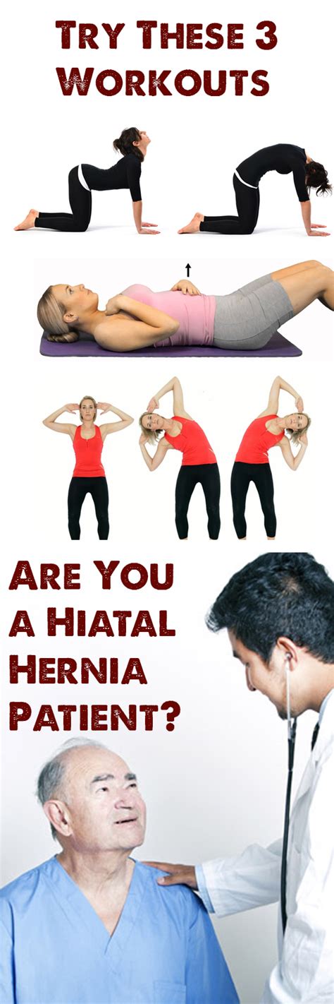 Are You A Hiatal Hernia Patient Try These Workouts