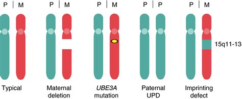 Angelman Syndrome Chromosome