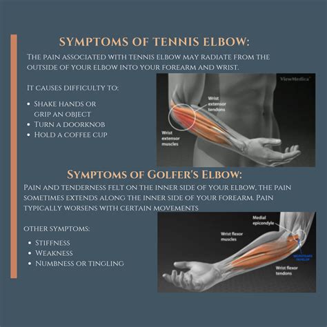 Tennis Elbow Test Fingersandfeathersh