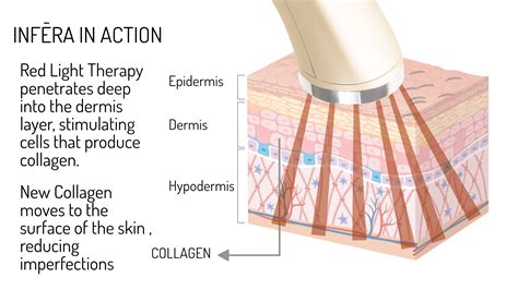 Infrared Light Therapy — InfĒra
