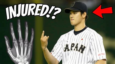 Shohei Ohtani Injury Angels Fans React Youtube