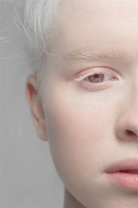 Beautiful Albino Girl With Red Lips On White Background Stock Image Image Of Albino Hair