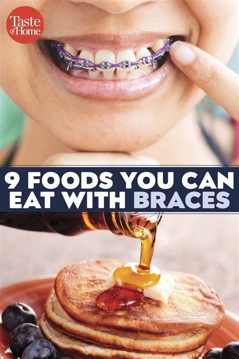 Yes, you can eat some chocolates with braces, but in strict moderation and only during meal times. 9 Foods You Can Eat With Braces | Braces food, Braces ...