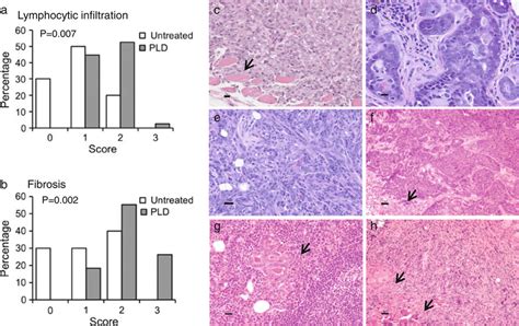 Histopathology Of Mammary Glands And Tumors In Fvbn Mice A