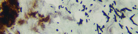 Cropped Human Peritonium Fungus 52 Gms Hanss Histology