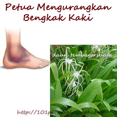 Saya tak pasti ianya disebabkan oleh petua tradisional menghilangkan kedut bawah mata yang ada kat bawah ni atau tidak, ataupun ia adalah kerana keberkesanan produk moden yang saya gunakan. 101 Petua: Petua Mengurangkan Bengkak di Kaki