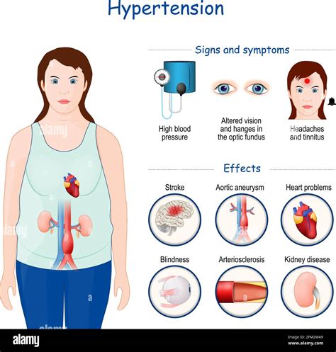 Hypertension Symptoms And Effects Stock Vector Images Alamy