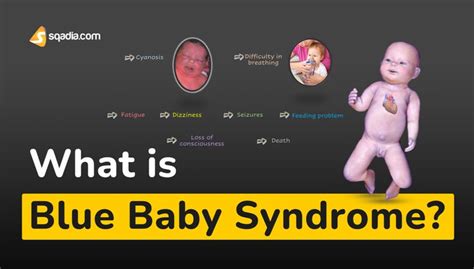 What Is Blue Baby Syndrome