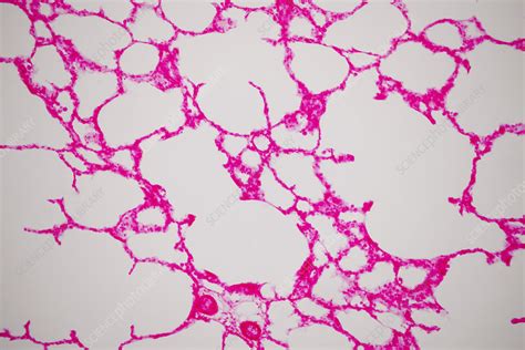 Human Lung Tissue Light Micrograph Stock Image F0323512 Science