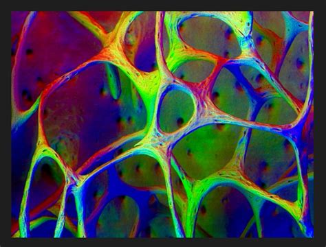 Pin By Anthony Schultz On Dance Of Colours Electron Microscope Images