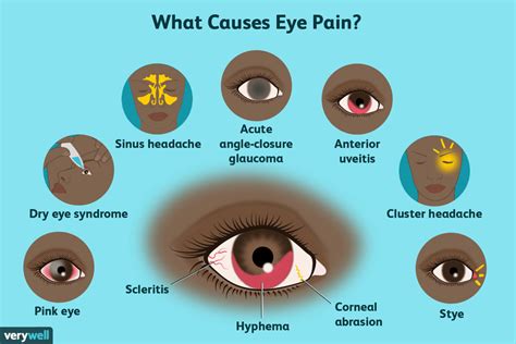 Eye Pain Causes Treatment And When To See A Healthcare Provider