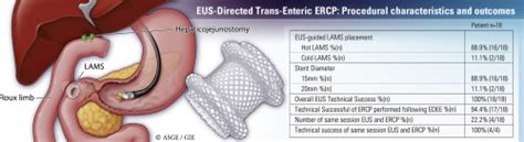 Eus Directed Transenteric Ercp In Nonroux En Y Gastric Bypass Surgical