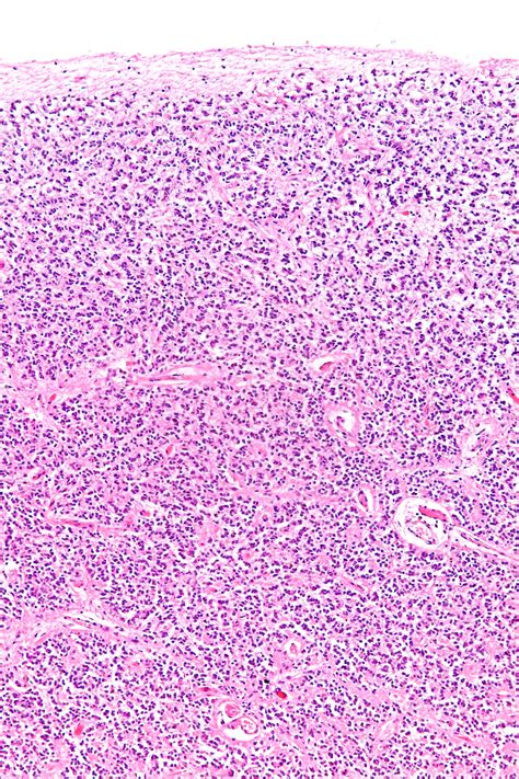 File:Pineal gland - intermed mag.jpg - Wikimedia Commons