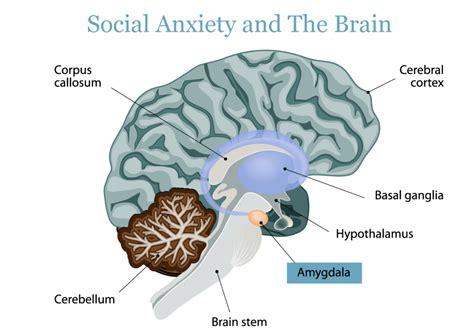 Causes Of Social Anxiety Bridges To Recovery