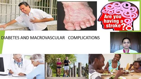 Chronic complications of diabetes mellitus. DIABETES AND MACROVASCULAR COMPLICATIONS - YouTube