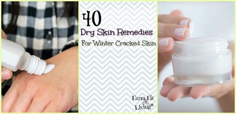 40 Dry Skin Remedies For Winter Cracked Skin Farm Fit Living