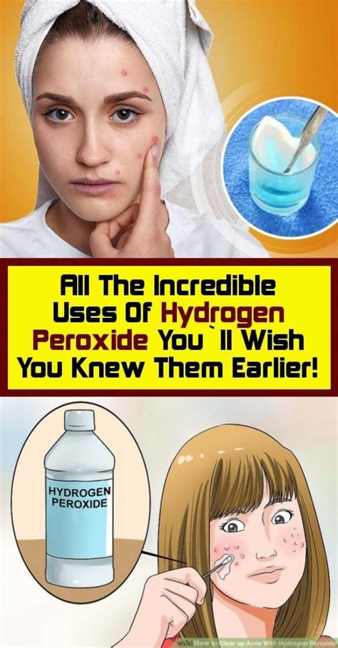 all the unbelievable uses of hydrogen peroxide you re going to want to know them before in