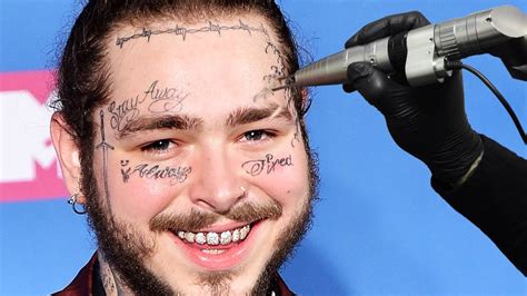 Removing POST MALONE S Face Tattoos YouTube