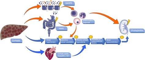 Acute Kidney Injury And Hepatorenal Syndrome In Cirrhosis