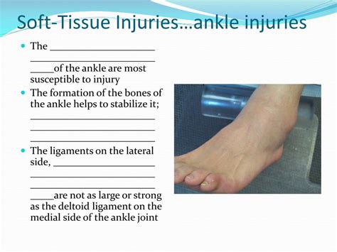 Ppt Injuries To The Lower Leg Ankle And Foot Powerpoint