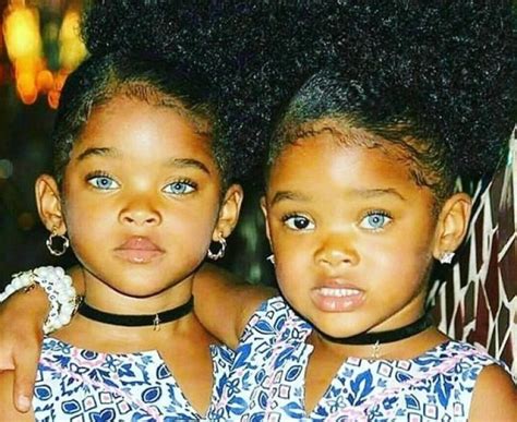 12 Years Have Passed Twin Sisters With Different Eye Colors Have Grown