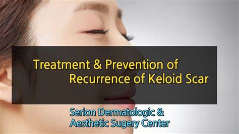 Treatment And Prevention Of Recurrence Of Keloid Scar Youtube