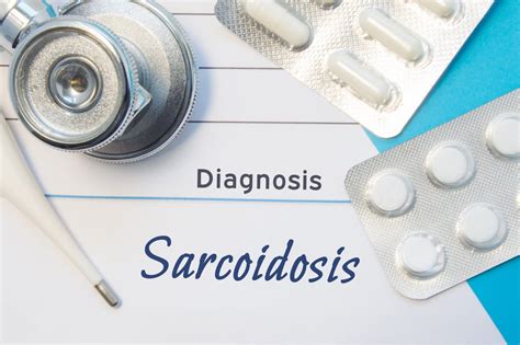 10 Treatments For Sarcoidosis Facty Health