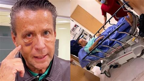 Alfredo Adame Es Operado De Emergencia Tras Brutal Golpiza Pasará La Noche En El Hospital