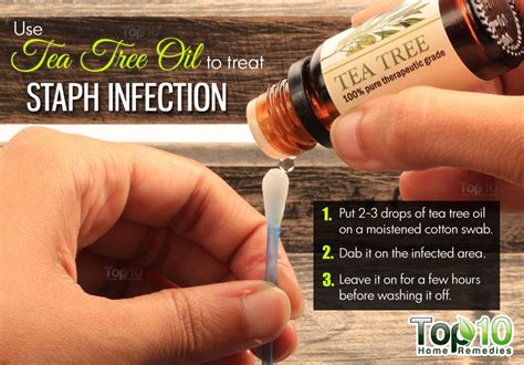 Home Remedies For Staph Infection Top 10 Home Remedies