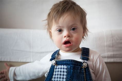 Iceland Murders Downs Syndrome Babies And Mourns The Loss Of A Glacier