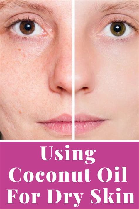 Using Coconut Oil For Dry Skin Will Bring These Surprising Benefits