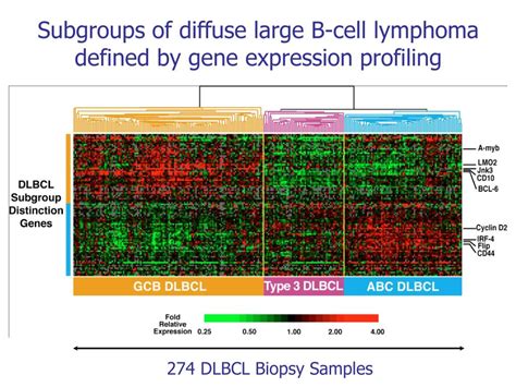 Ppt Lymphomes Diffus à Grandes Cellules B Facteurs Pronostiques Et