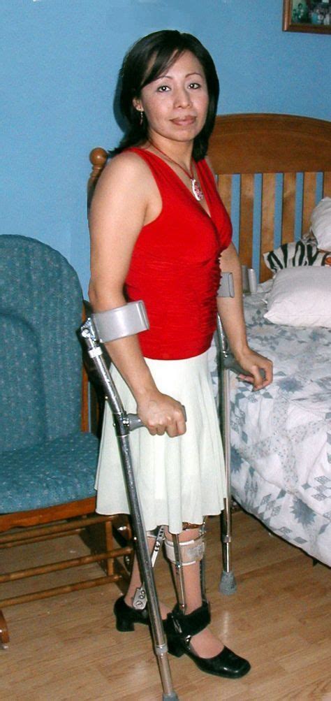 Pin By Brenda Brooks On Beautiful Disabled Women Leg Braces Disabled
