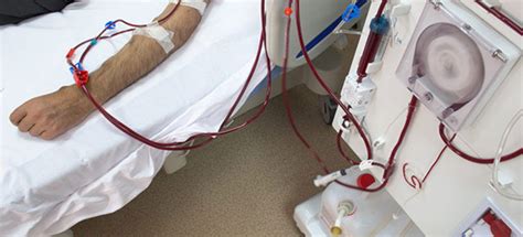What Is Dialysis Difference Between Hemodialysis And Peritoneal Dialysis