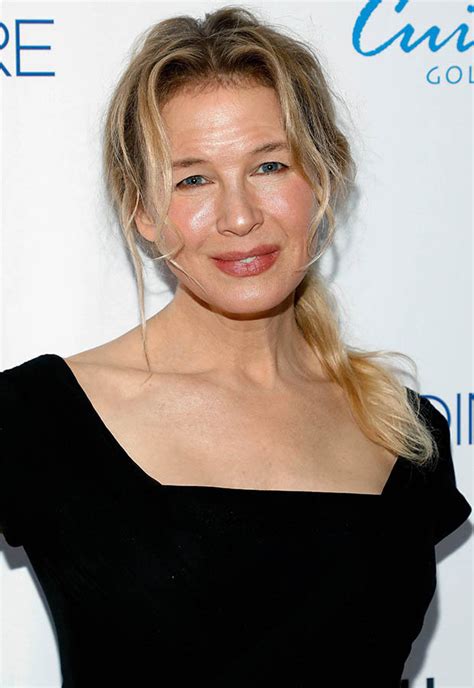 Renee Zellweger Face Transformation Plastic Surgeon Dissects Shock New