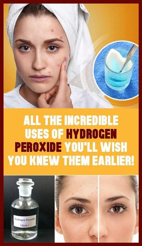 Canker sores are gray or white sores surrounded by a red inflamed area. All The Incredible Uses Of Hydrogen Peroxide- You`ll Wish ...