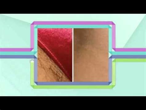 Bikini zone hair removal (self.twoxchromosomes). Bikini Zone Hair Removal - YouTube
