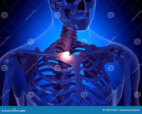 A Painful Clavicle Joint Stock Illustration Illustration Of Painful